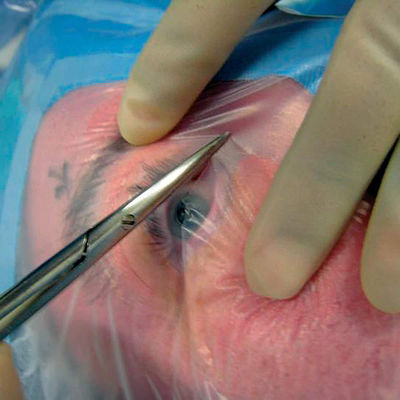 Chirurgico sterile eliminabile del modellatore oftalmico di Formable copre con il supporto del cavo
